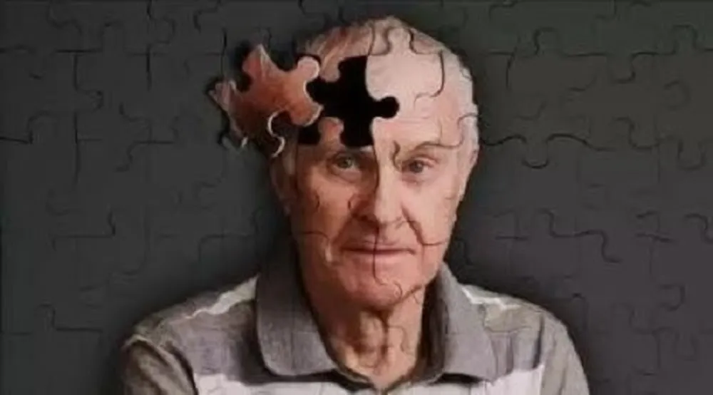 老年痴呆症是老人杀手之一。